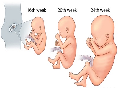 Screening for Down Syndrome in First & Second Trimester